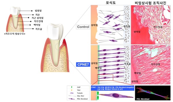 CPNE7 단백질과 CPNE7-유래 펩타이드가 TAU 단백질과 CAP 단백질의 발현을 조절, 치주인대를 재생하고 치주인대가 치아 백악질에 잘 부착되도록 해 손상된 치주조직의 기능을 회복시킨다.