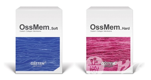 'OssMem Soft'(왼쪽)와 'OssMem Hard'